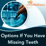Options If You Have Missing Teeth