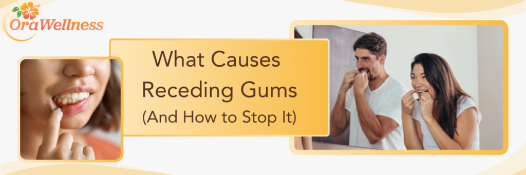 What Causes Receding Gums (And How to Stop It)