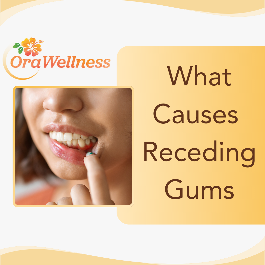 What causes receding gums and how to stop it - OraWellness