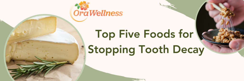 Top Five Foods for Stopping Tooth Decay