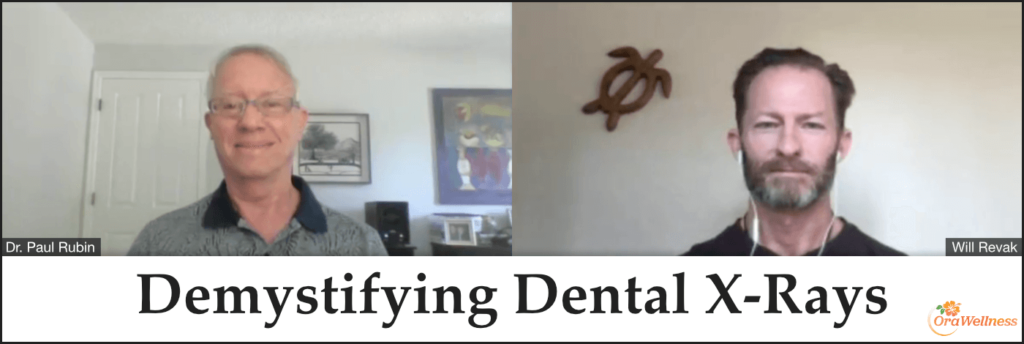 Demystifying Dental X-Rays expert interview with Dr. Paul Rubin